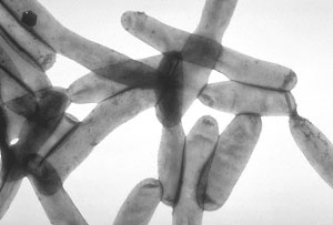 Legionela. Fuente imagen: Wikipedia